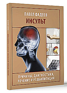 Инсульт. Причины, диагностика, лечение и реабилитация