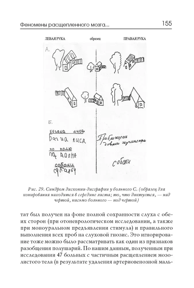 Neuropsychological syndromes in cerebrovascular disorders